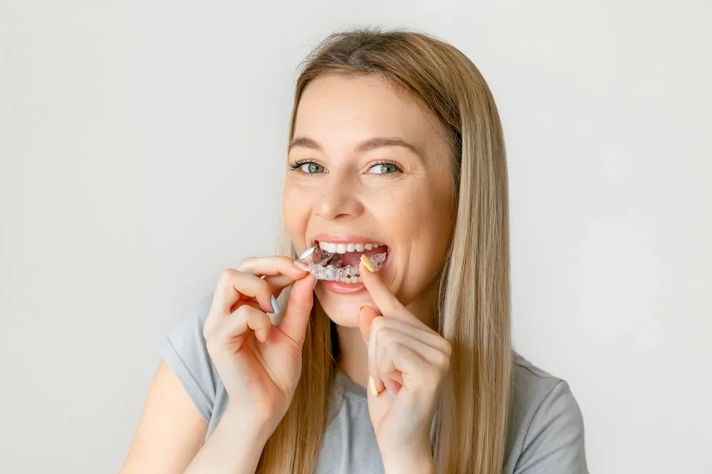 A close-up of a patient's smile with orthodontic braces